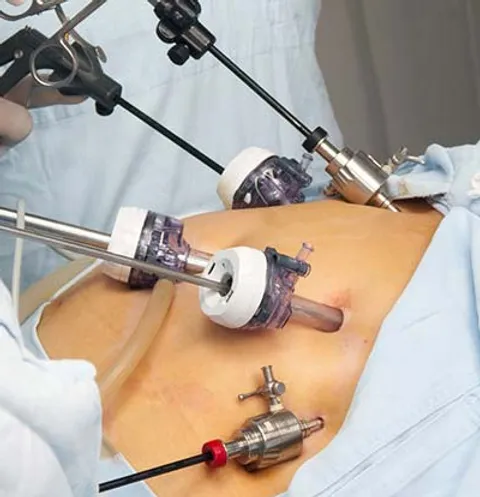 Minimal Access Surgery Gynecology Orthopaedics Urology Laser Critical care Minimal Access Surgery